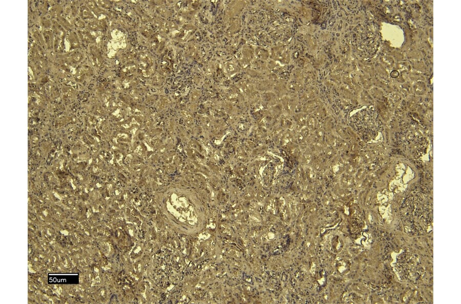 Immunohistochemistry - Anti-SDHB Antibody (A84115) - Antibodies.com