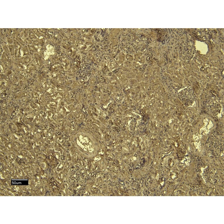 Immunohistochemistry - Anti-SDHB Antibody (A84115) - Antibodies.com