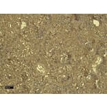 Immunohistochemistry - Anti-SDHB Antibody (A84115) - Antibodies.com