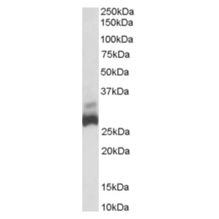 Western Blot - Anti-SDHB Antibody (A84115) - Antibodies.com