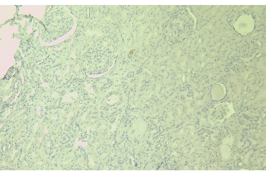 Immunohistochemistry - Anti-SDHB Antibody (A84115) - Antibodies.com