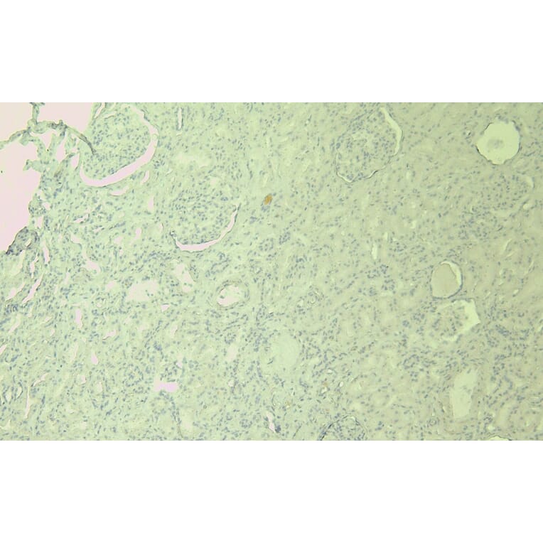 Immunohistochemistry - Anti-SDHB Antibody (A84115) - Antibodies.com