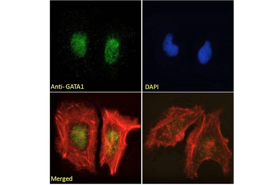 Immunofluorescence - Anti-GATA1 Antibody (A84117) - Antibodies.com