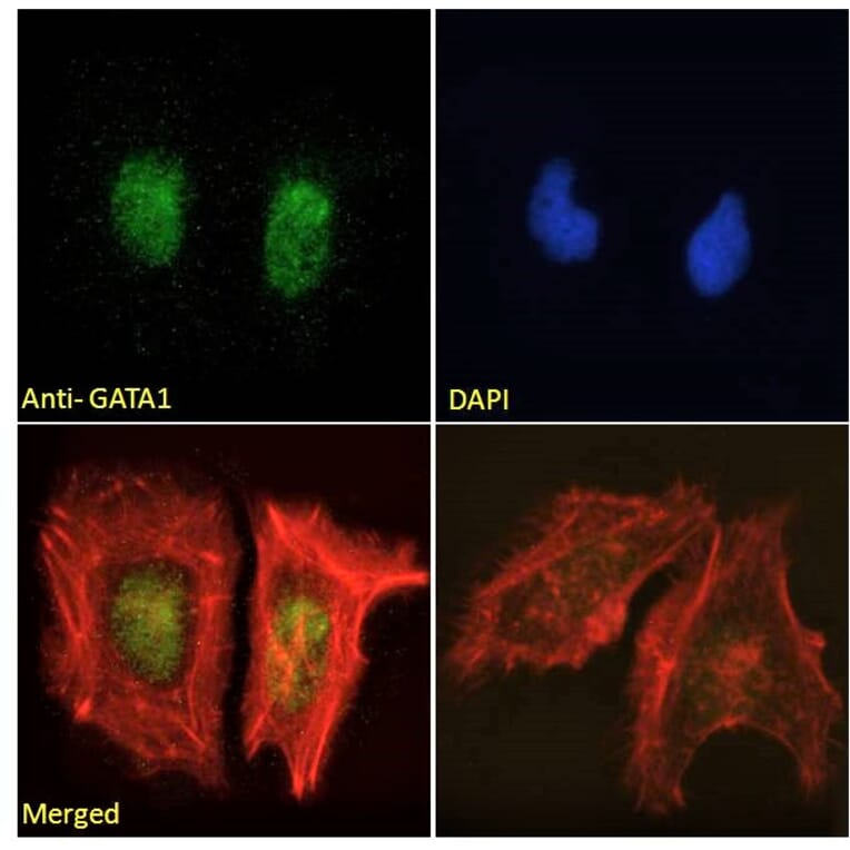 Immunofluorescence - Anti-GATA1 Antibody (A84117) - Antibodies.com