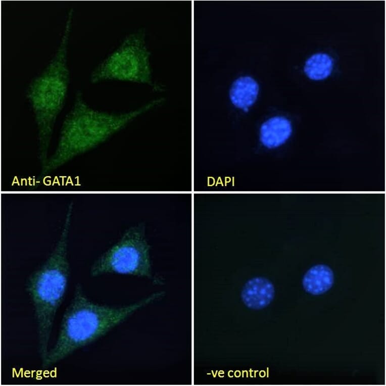 Immunofluorescence - Anti-GATA1 Antibody (A84117) - Antibodies.com