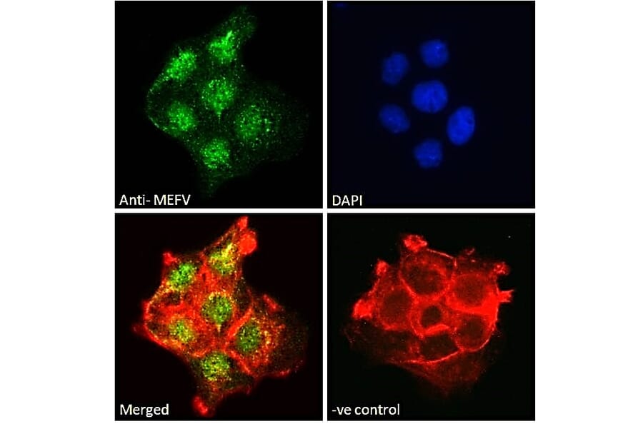 Immunofluorescence - Anti-Pyrin Antibody (A84118) - Antibodies.com