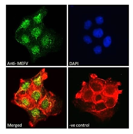 Immunofluorescence - Anti-Pyrin Antibody (A84118) - Antibodies.com