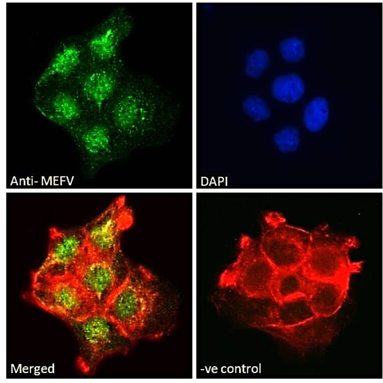 Immunofluorescence - Anti-Pyrin Antibody (A84118) - Antibodies.com