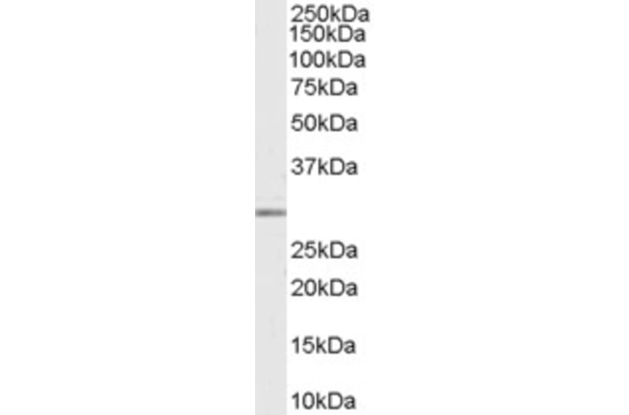 Western Blot - Anti-MMP7 Antibody (A84120) - Antibodies.com