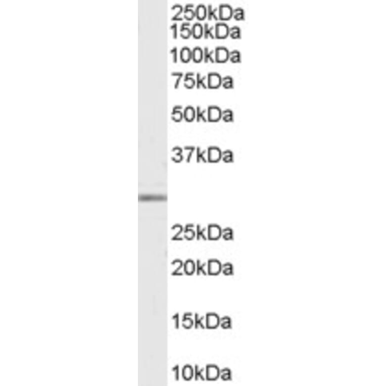 Western Blot - Anti-MMP7 Antibody (A84120) - Antibodies.com