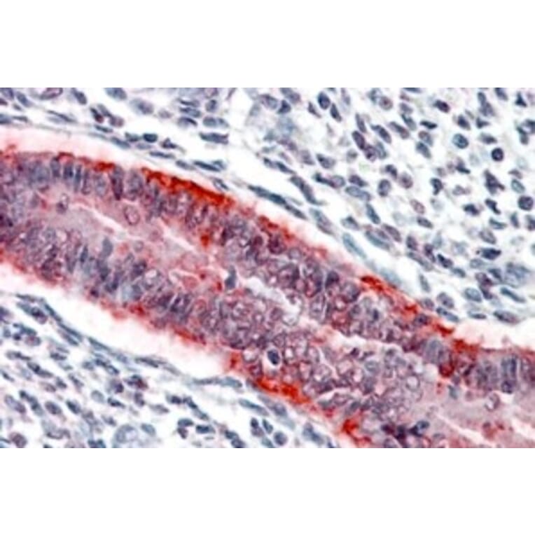 Immunohistochemistry - Anti-MMP7 Antibody (A84120) - Antibodies.com