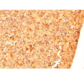 Immunohistochemistry - Anti-CFC1 Antibody (A84121) - Antibodies.com