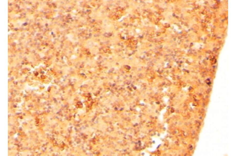 Immunohistochemistry - Anti-CFC1 Antibody (A84121) - Antibodies.com