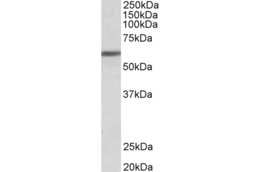 Western Blot - Anti-ZNF703 Antibody (A84122) - Antibodies.com