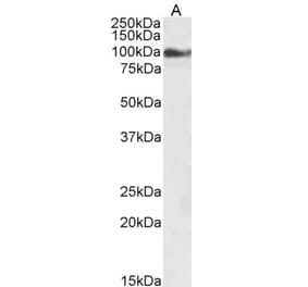 Western Blot - Anti-TRPC6 Antibody (A84123) - Antibodies.com