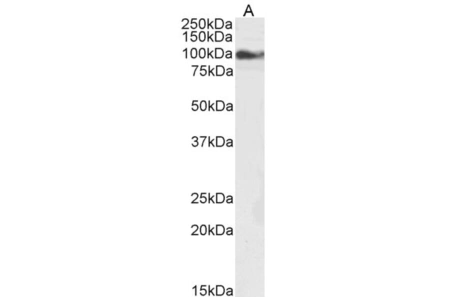 Western Blot - Anti-TRPC6 Antibody (A84123) - Antibodies.com