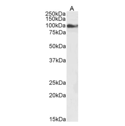 Western Blot - Anti-TRPC6 Antibody (A84123)