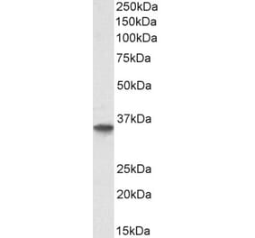 Western Blot - Anti-GDF15 Antibody (A84124) - Antibodies.com