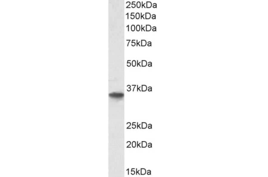 Western Blot - Anti-GDF15 Antibody (A84124) - Antibodies.com