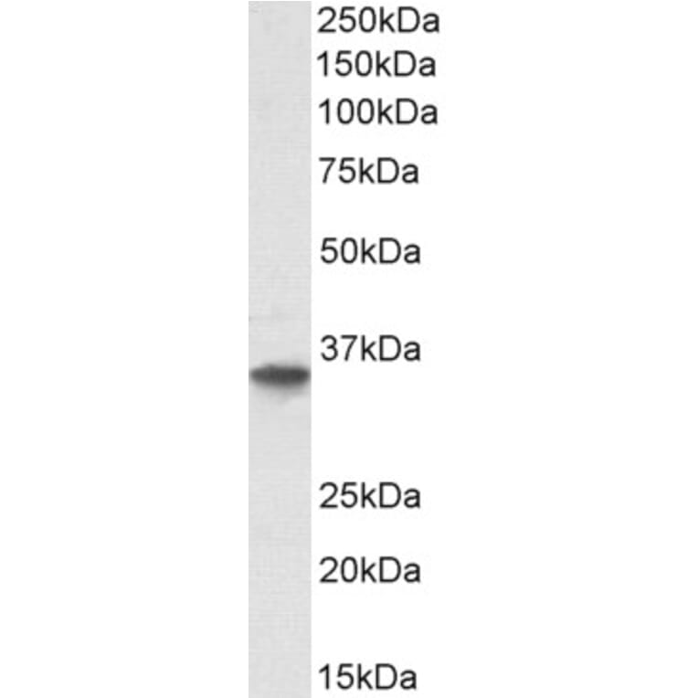 Western Blot - Anti-GDF15 Antibody (A84124) - Antibodies.com