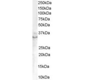 Western Blot - Anti-GDF15 Antibody (A84124) - Antibodies.com