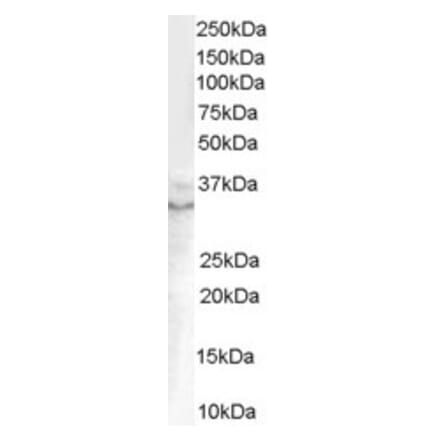 Western Blot - Anti-GDF15 Antibody (A84124) - Antibodies.com