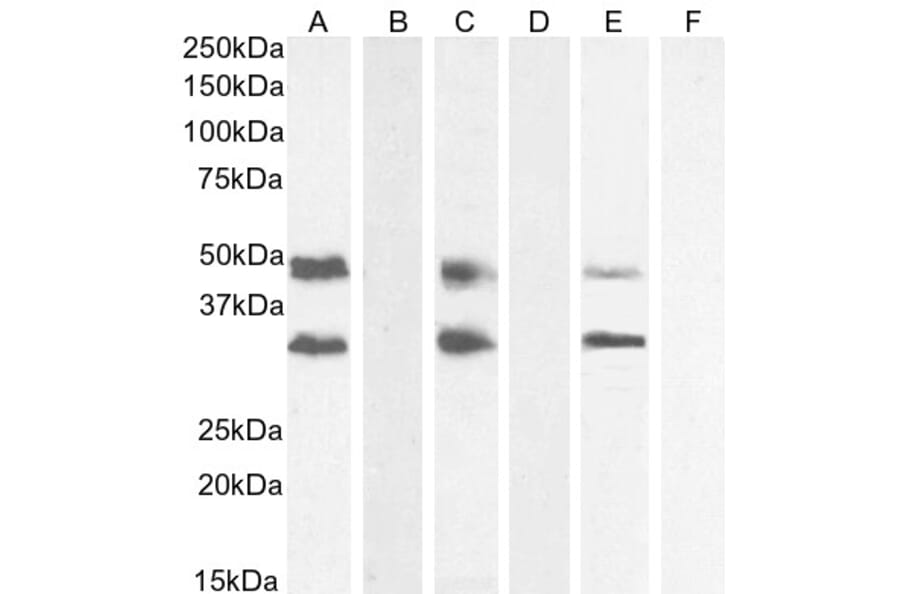 Western Blot - Anti-GDF15 Antibody (A84124) - Antibodies.com
