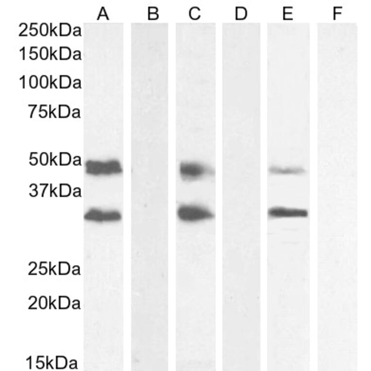 Western Blot - Anti-GDF15 Antibody (A84124) - Antibodies.com