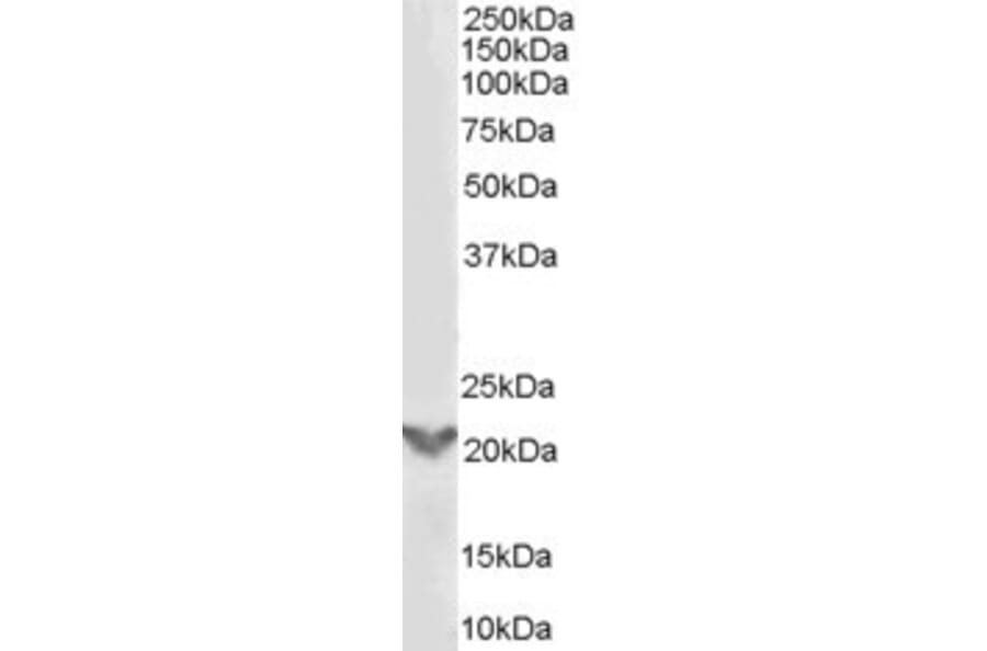 Western Blot - Anti-TGIF2 Antibody (A84125) - Antibodies.com