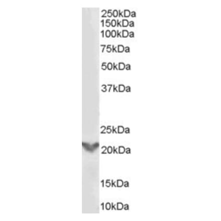 Western Blot - Anti-TGIF2 Antibody (A84125) - Antibodies.com