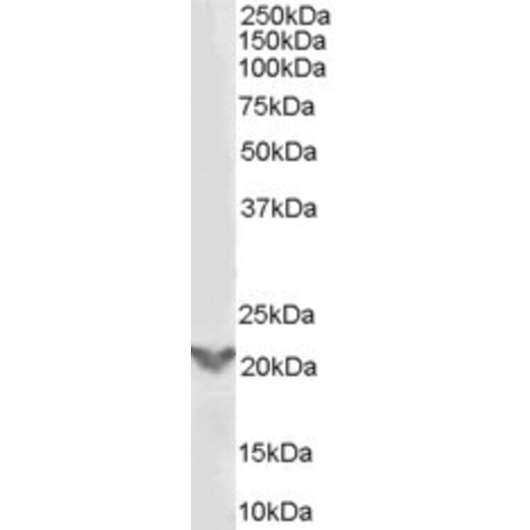 Western Blot - Anti-TGIF2 Antibody (A84125) - Antibodies.com