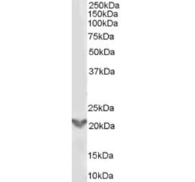 Western Blot - Anti-TGIF2 Antibody (A84125) - Antibodies.com