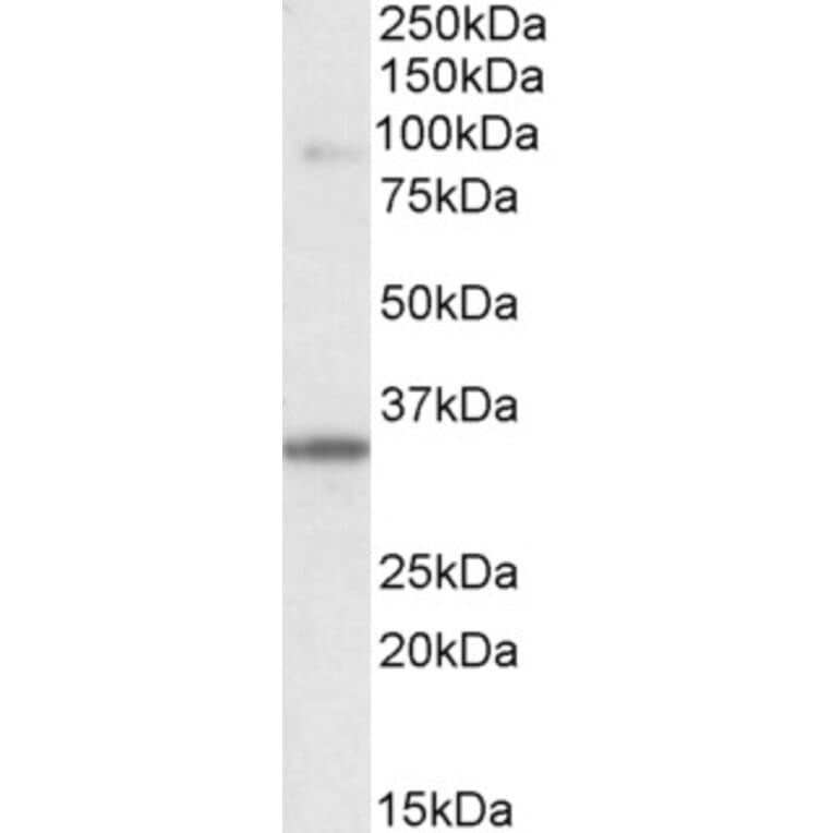 Western Blot - Anti-LDB3 Antibody (A84127) - Antibodies.com