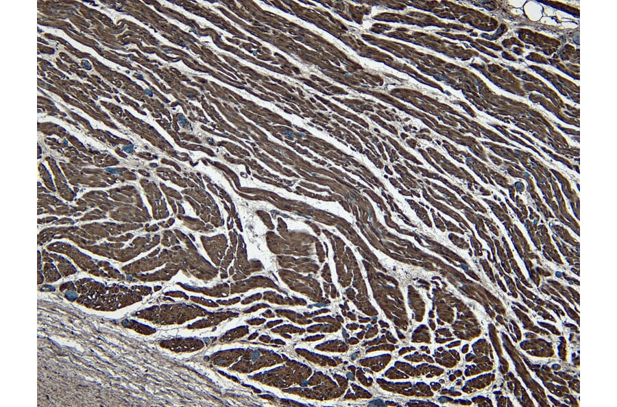 Immunohistochemistry - Anti-LDB3 Antibody (A84127) - Antibodies.com