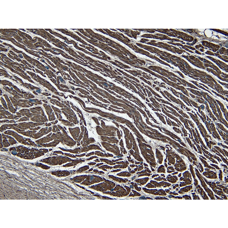 Immunohistochemistry - Anti-LDB3 Antibody (A84127) - Antibodies.com
