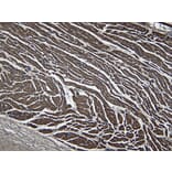 Immunohistochemistry - Anti-LDB3 Antibody (A84127) - Antibodies.com