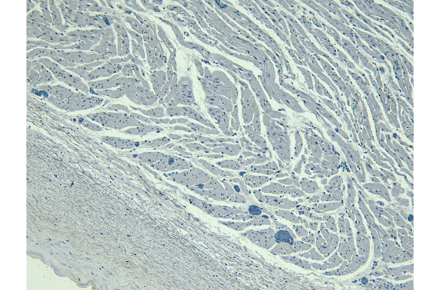 Immunohistochemistry - Anti-LDB3 Antibody (A84127) - Antibodies.com