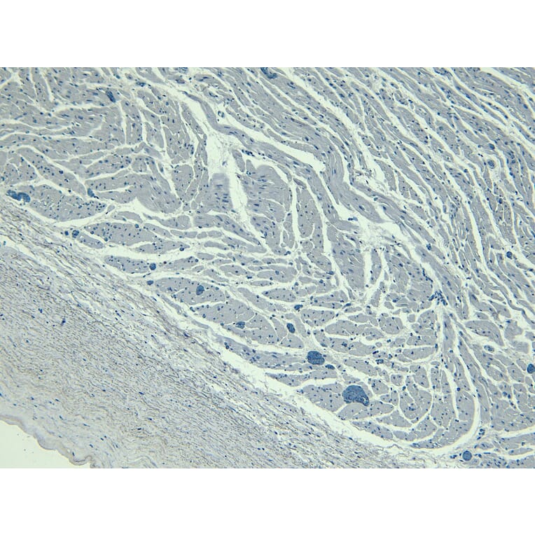 Immunohistochemistry - Anti-LDB3 Antibody (A84127) - Antibodies.com