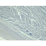 Immunohistochemistry - Anti-LDB3 Antibody (A84127) - Antibodies.com