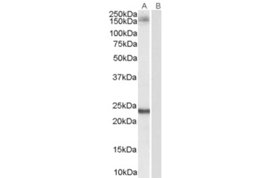 Western Blot - Anti-GOLGA3 Antibody (A84128) - Antibodies.com