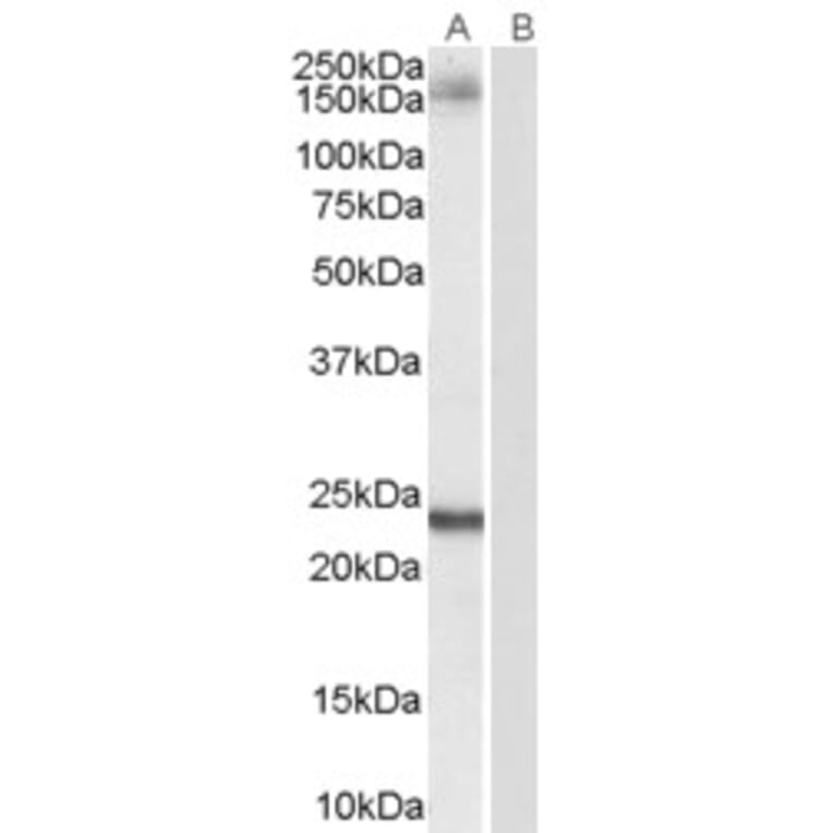 Western Blot - Anti-GOLGA3 Antibody (A84128) - Antibodies.com