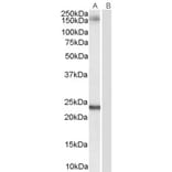 Western Blot - Anti-GOLGA3 Antibody (A84128) - Antibodies.com