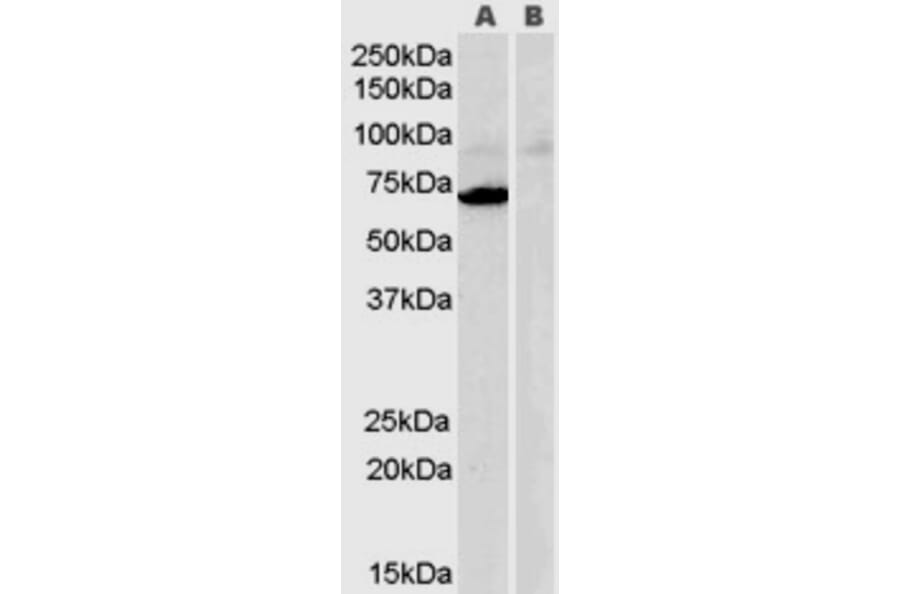 Western Blot - Anti-Monoamine Oxidase A/MAO-A Antibody (A84129) - Antibodies.com
