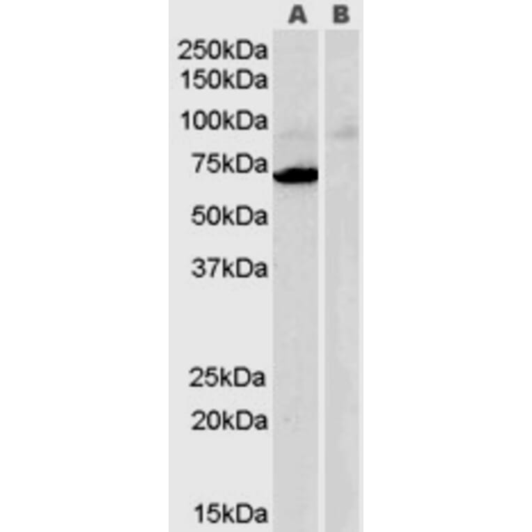 Western Blot - Anti-Monoamine Oxidase A/MAO-A Antibody (A84129) - Antibodies.com