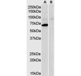 Western Blot - Anti-MAOA Antibody (A84129) - Antibodies.com