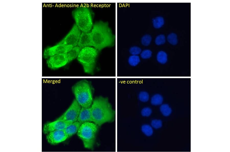 Immunofluorescence - Anti-Adenosine A2b Receptor/ADORA2B Antibody (A84130) - Antibodies.com