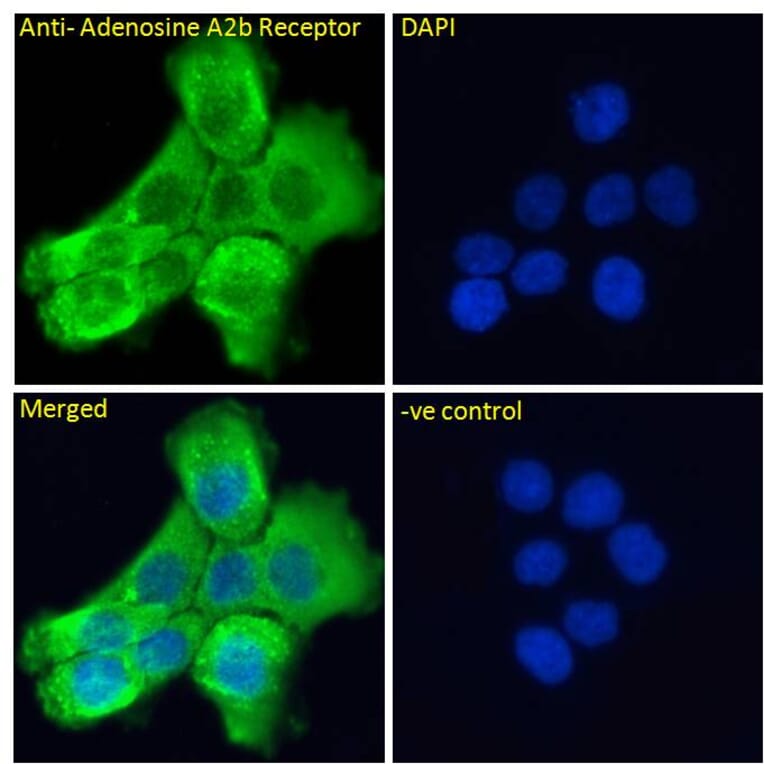 Immunofluorescence - Anti-Adenosine A2b Receptor/ADORA2B Antibody (A84130) - Antibodies.com