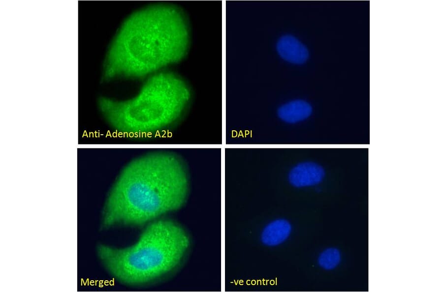 Immunofluorescence - Anti-Adenosine A2b Receptor/ADORA2B Antibody (A84130) - Antibodies.com