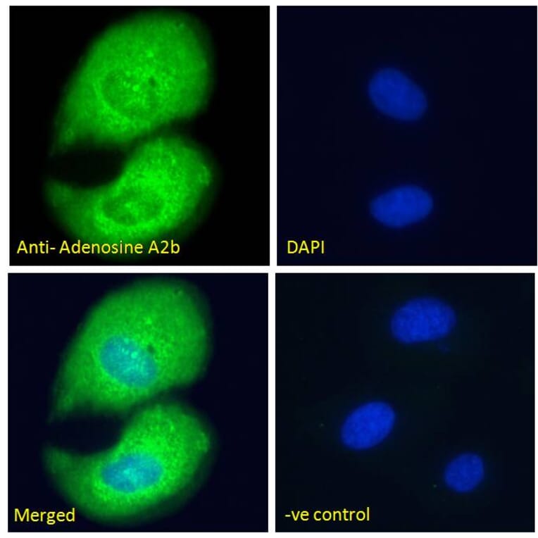 Immunofluorescence - Anti-Adenosine A2b Receptor/ADORA2B Antibody (A84130) - Antibodies.com