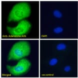 Immunofluorescence - Anti-Adenosine A2b Receptor/ADORA2B Antibody (A84130) - Antibodies.com
